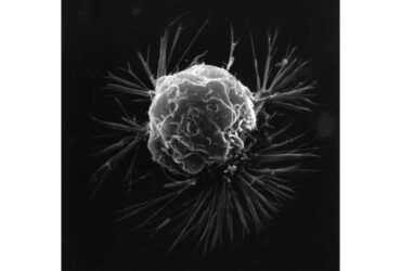 cancer-cell-01