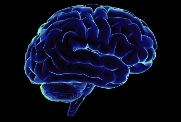 Brain Parkinson