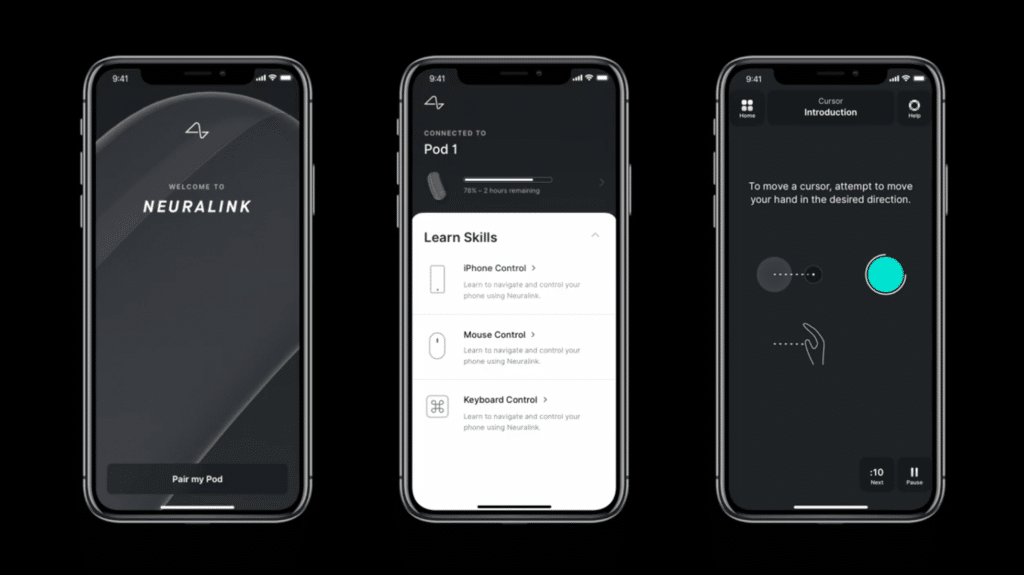 App Neuralink