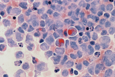 ©National Cancer Institute